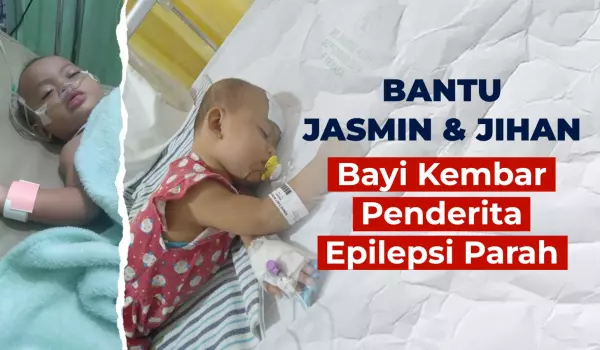 Bantu Bayi Kembar, Jasmin dan Jihan Berjuang Lawan Epilepsi Parah