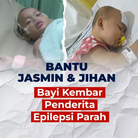 Bantu Bayi Kembar, Jasmin dan Jihan Berjuang Lawan Epilepsi Parah